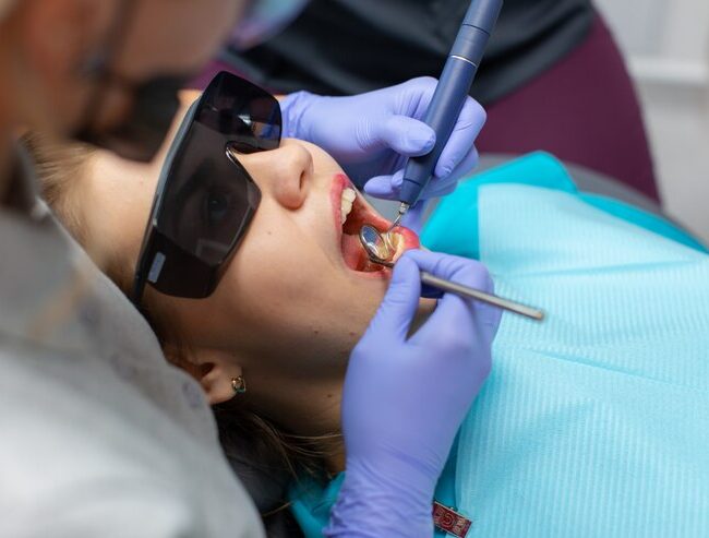 Composite Fillings in Lakewood Ranch