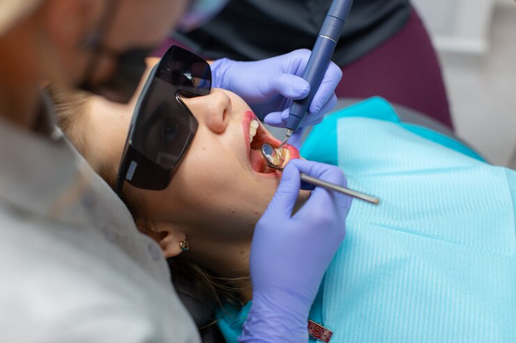 Composite Fillings in Lakewood Ranch